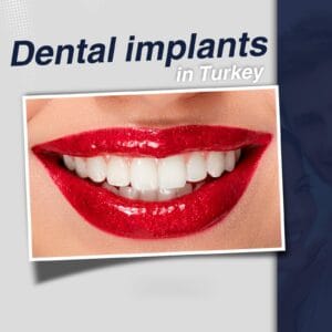 Implants & Hollywood Smile in Turkey