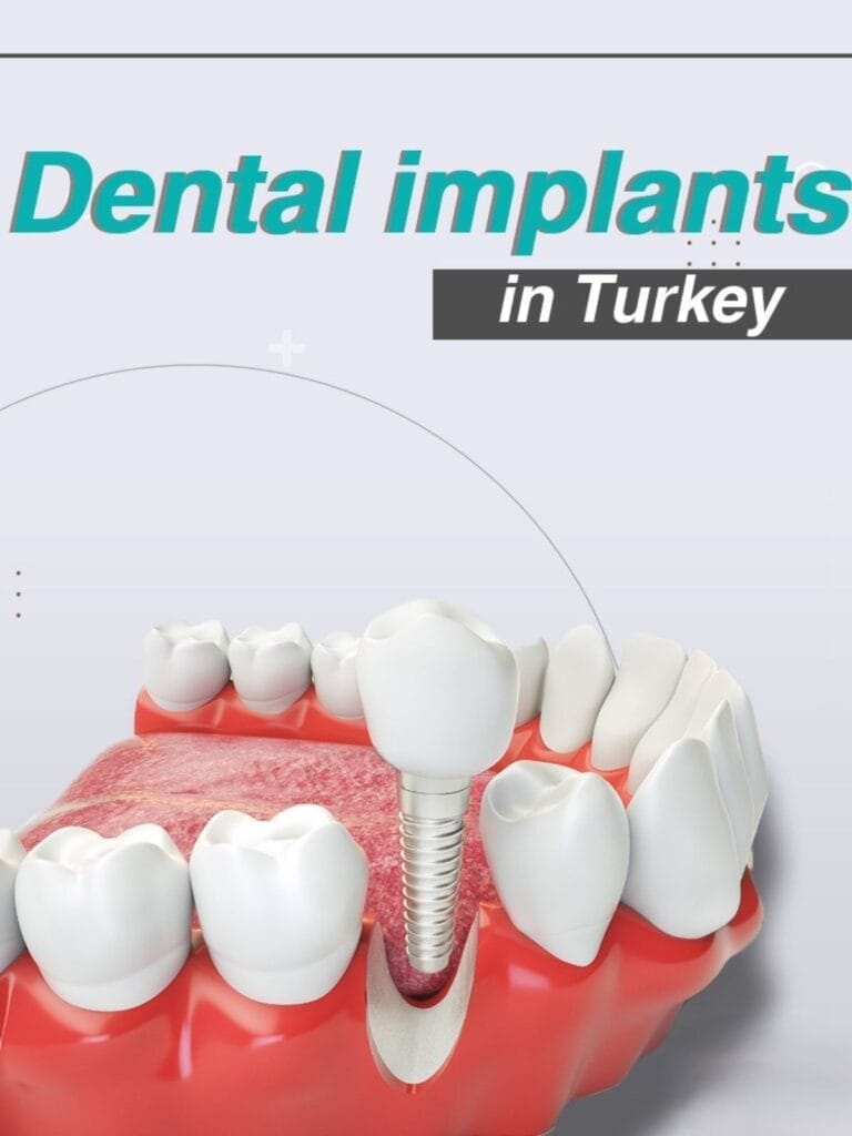 Specialised Dentists Implants