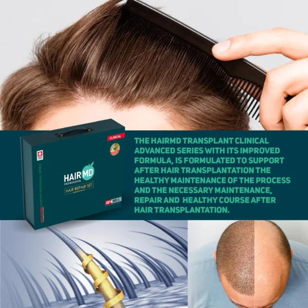 HairMD Clinical Hair Complex Meso Serum 10x with Dermaroller – complete set HairMD Meso Serum 6ml ampoules – intensive follicle treatment Dermaroller for hair regrowth – scalp stimulation tool HairMD Hair Growth Kit – 10x meso serum + dermaroller Anti hair loss mesotherapy set – HairMD serum and dermaroller