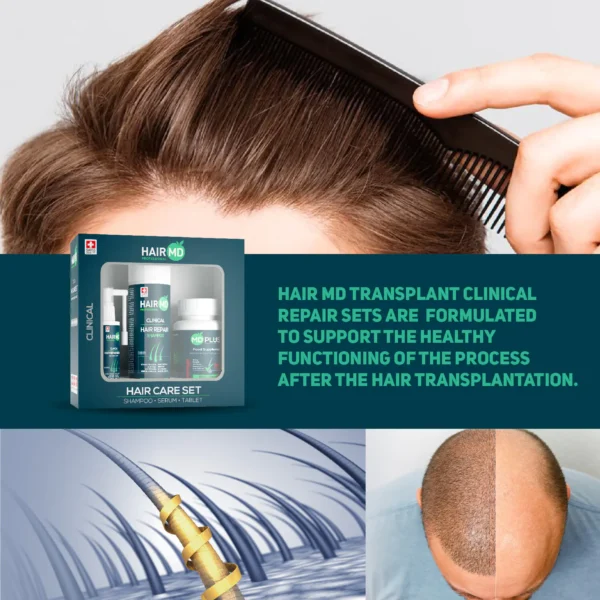 HairMD Clinical Hair Complex Meso Serum 10x with Dermaroller – complete set HairMD Meso Serum 6ml ampoules – intensive follicle treatment Dermaroller for hair regrowth – scalp stimulation tool HairMD Hair Growth Kit – 10x meso serum + dermaroller Anti hair loss mesotherapy set – HairMD serum and dermaroller